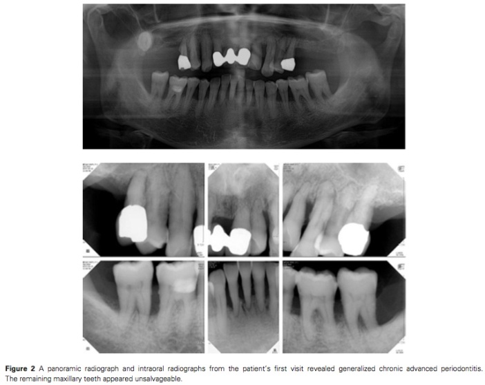 J Prosthodontics 2015 Vol.24-3